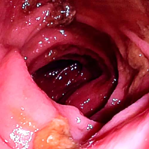 Centro Médico Endoscopia Ovalle