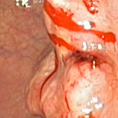 Centro Médico Endoscopia Ovalle